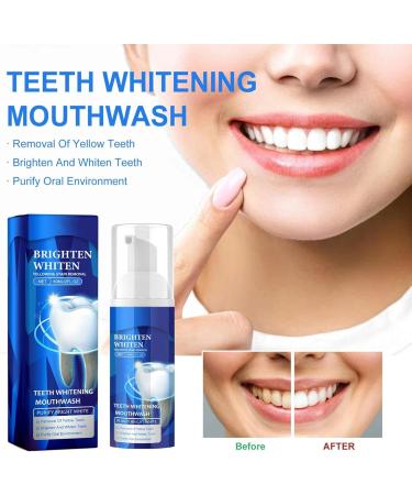 Bright Whitening Teeth Mousse | Herbal Oral Repair & Mouthwash Foam | Refreshing Deep Cleaning Breath Care (1PC) - Buy Online on GoSupps.com