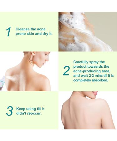 BAInuai Acne Backacne spray acne treatment spray acne spray for back and body tea tree oil for back acne solution 120 ml - Buy Online on GoSupps.com