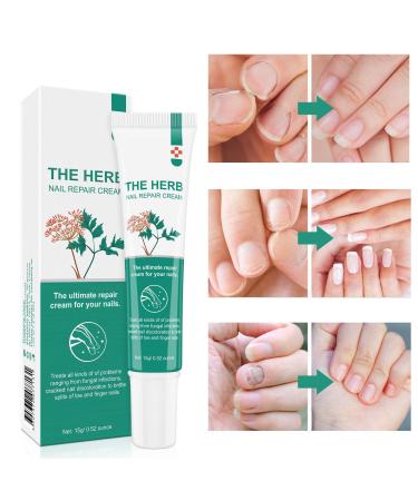 Nail Repair Cream Toenail F ngus Treatment Maximum Strength Nail Fu_ngus Treatment Repair Damaged & Discoloration Nail Restores the Healthy Appearance of Nails