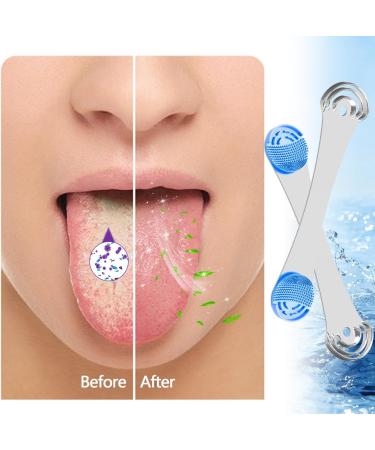 Stainless Steel Tongue Scraper for Adults & Kids - Fresh Breath Tongue Cleaner with 2 Replacement Silicone Pads (Blue) - Buy Online on GoSupps.com