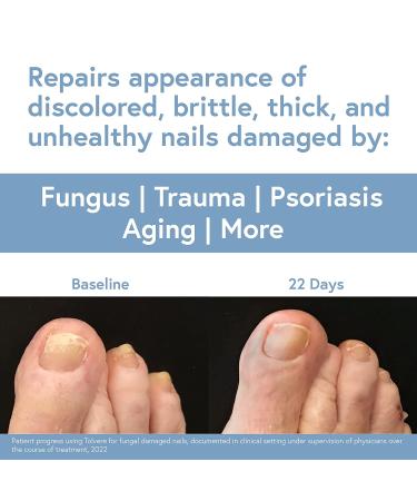 Tolvere Nail Renewal Solution | Rapidly Improve Nail Appearance | Tolcylen Makers | Discolored, Brittle & Cracked Nail Treatment - Buy Online on GoSupps.com