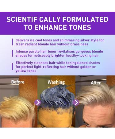 Crsetmyth Shampoo AntiGel Stitches 2 Pieces Intensive Silver Anti Gel Stitches Toning Violet ColorConfirming Shampoo Color Retaining For Blonde And Gray Hair For The Neutralization Of Gels - Buy Online on GoSupps.com