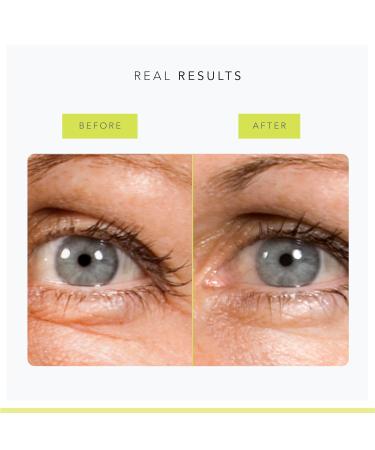 Buy STEM CELLULAR SuperGrape Youth Renew Serum - Hydrating Hyaluronic Acid Serum for Plump Youthful Skin - Ships Internationally - Buy Online on GoSupps.com