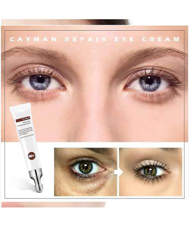 VYOFLA Magic Eye Cream - 2022 New Anti-aging Solution | Rapidly Removes Eye Bags, Wrinkles & Dark Circles in 28 Seconds | Vibrant Glamour Formula | 1PCS - Buy Online on GoSupps.com