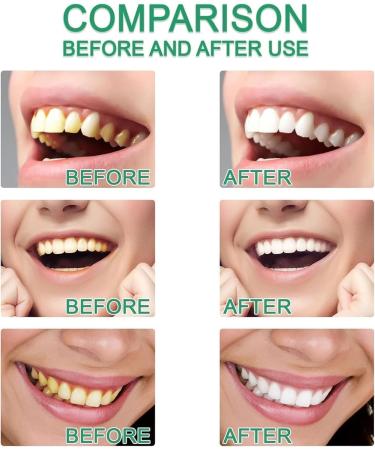 Bodyexcel Dentifrice dentifrice Tribright p te dentaire Bodyexcel Niacinamide dentifrice Bodyexcel dentifrices Ascart Radiant (2) - Buy Online on GoSupps.com
