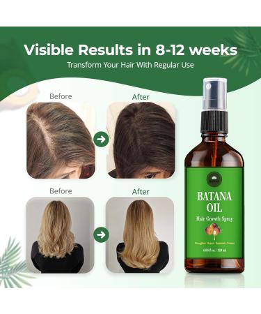 SAHAK Natural Batana Oil Hair Spray | 100% Pure Dr. Sebi Organic Solution for Nourishing Thickening & Moisturizing Hair | 4 oz - International Shipping Available - Buy Online on GoSupps.com