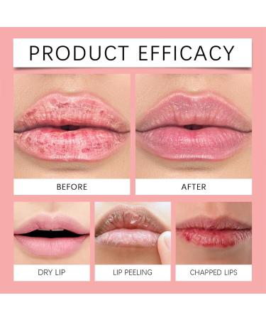 Watermelon Lip Masque Tinted Moisturizing Balm - Tinted Lip Balm Watermelon Lip Masque Overnight Lip Balm for Dry Chapped Peeling Cracked Lips - Buy Online on GoSupps.com
