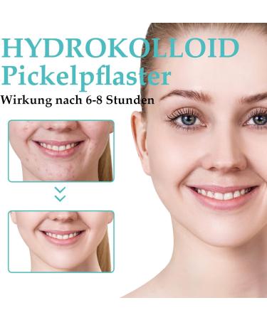 Fonyiunce 300 pieces pimples for daily and evening use invisible hydrocolloid acne patches with tea oil and salicylic acid can eliminate acne quickly - Buy Online on GoSupps.com