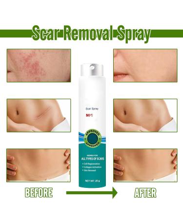 Heal Scar Care Spray | Advanced Formula for All Scar Types | 80g - Enhance Healing & Reduce Visibility - Buy Online on GoSupps.com