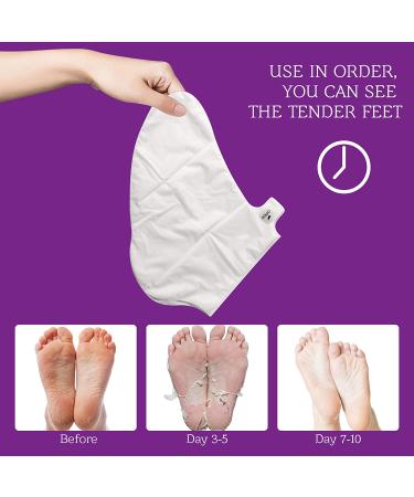 Foot Peel Mask - 5 Pack | Exfoliating Feet Mask for Baby Soft Skin | Repair Dead Skin, Calluses & Cracked Heels - Lavender Scented - Buy Online on GoSupps.com
