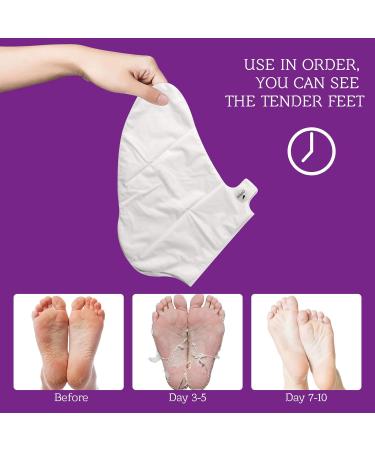 Lavender Foot Peel Mask - 5 Pack for Callus Removal and Soft Feet | Exfoliating Foot Mask for Men and Women - Buy Online on GoSupps.com