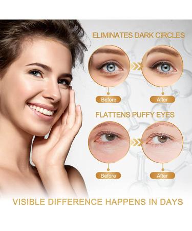 TMESL Under Eye Patches - 30 Pairs 24K Gold Anti-Aging Eye Masks with Hyaluronic Acid and Collagen for Dark Circles, Puffiness & Wrinkles - Deeply Hydrating Eye Treatment - Buy Online on GoSupps.com