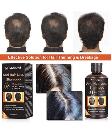 Natural Hair Growth Shampoo for Thicker, Fuller Hair - Organic Hair Loss Treatment - 7.43 Fl Oz - Buy Online on GoSupps.com