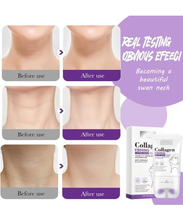 Neck Creams for Firming Roller - Collagen Neck Cream - Retion Neck Firming Cream - Anti Aging and Anti Wrinkle Neck Cream - Rich in Vitamin C+E and Hyaluronic Acid - Neck Moisturizer - Buy Online on GoSupps.com