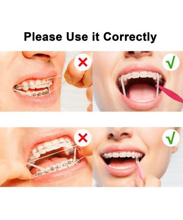 Jaw-Friendly Elastic Rubber Bands for Braces - 500 Tooth Traction Straps (5 Pieces 0.6 cm Fox) | International Shipping - Buy Online on GoSupps.com