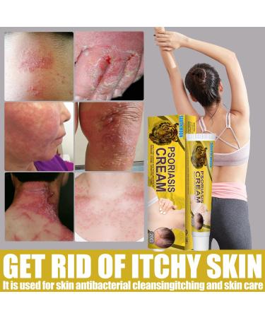 G-SHOTOY Revitaskin Eczema Cure Cream - Relief and Treatment for Adults with Psoriasis - Healthy Skin Treatment (2pcs) - Buy Online on GoSupps.com
