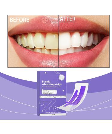 Bande Violette Blanchiment Dentaire Bande Blanchiment Dentaire Violet Teeth Whitening Strips Nano Hydroxyapatite Bandes Violette Kit Blanchiment Dentaire limine Taches Caf /Th /Vin (3) - Buy Online on GoSupps.com