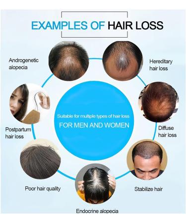 Professional Light Therapy Helmet for Hair Regrowth and Hair Loss Treatment Ideal for Thinning Hair Treatment Women and Men - Buy Online on GoSupps.com