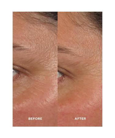 IMAGE Skincare AGELESS Total Facial Cleanser & Pure Hyaluronic 6 Filler Serum Set - Hydrate Cleanse & Revitalize Skin | Anti-Aging Solution (6 oz + 1 fl oz) - International Shipping Available - Buy Online on GoSupps.com