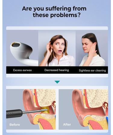 BEBIRD R1 Ear Wax Removal Tool with 1080P Otoscope, 2 Silicone Ear Scoops, 6 LED Lights, Compatible with All Mobile Phones - Black - Buy Online on GoSupps.com