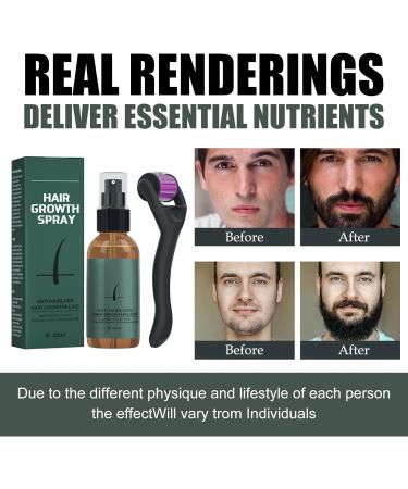 Beard Growth Kit for Men - Beard Roller, Oil, Balm, Styling Comb Set C - Perfect Birthday Father's Gift for Him - Buy Online on GoSupps.com