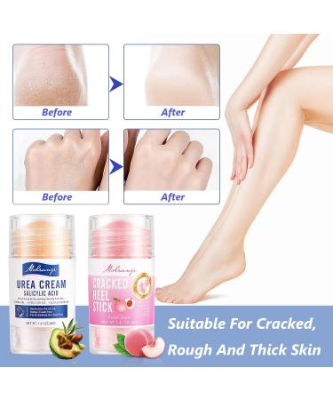 Dongcill 2 pieces moisturizing and anticracking foot cream moisturizing and anticracking foot cream very dry feet foot cream dry feet relieves dry and cracked feet - Buy Online on GoSupps.com