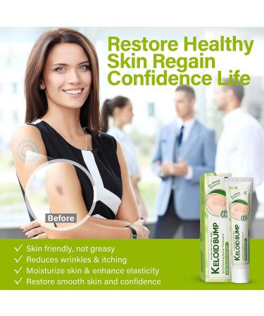 iTecFreely Keloid Scar Treatment for Nose & Belly Piercings - Silicone Scar Gel for Stretch Marks, Burns & Surgery Scars - Buy Online on GoSupps.com