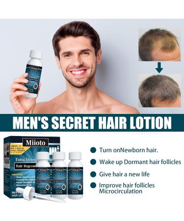 Miioto Hair Growth Serum for Men - Nourish Scalp & Prevent Hair Loss | Promotes Thicker Hair - 3x60ml - Buy Online on GoSupps.com