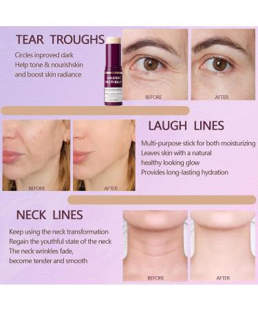 Calcium Multi Balm Stick, Multi Balm Stick, Calcium Volume Multi Balm, Moisturizer Stick, Under Eye Cream for Dark Circles & Wrinkles, Hydrating, Firming Skin, Suitable for Eyes, Neck, Face (1) - Buy Online on GoSupps.com