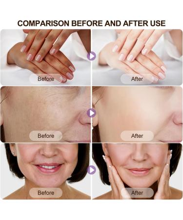Niacinamide Serum Serum B5 Vitamin B3 Serum Anti-Wrinkle Serum for a Radiant Skin Tone and Minimised Pores Against the First Signs of Skin Ageing - Buy Online on GoSupps.com