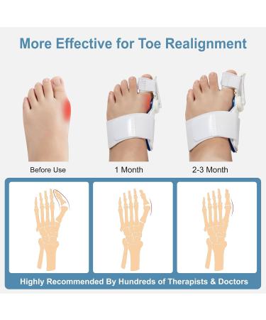 Bunion Corrector Toe Straightener - Big Toe Straightener for Men & Women | International Shipping Available - Buy Online on GoSupps.com