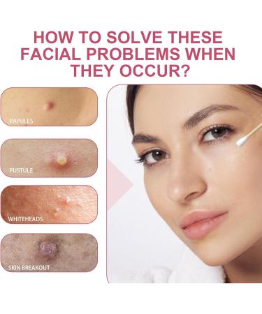 Nmbol Salicylic Acid Face Serum 3 - Buy Online on GoSupps.com