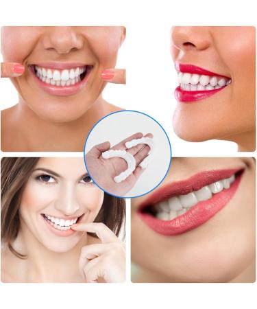 Frenzify Teeth Whitening Set - 2 Pairs Cosmetic Veneers & Snap-On Prostheses for Men & Women - Perfect Fix for Bad Teeth - Buy Online on GoSupps.com