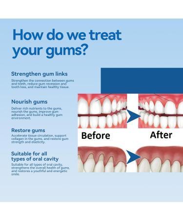  GNAUMORE Therapeutic Gel For Gums Gel For Periodontal Treatment Repair Gum Swelling Teeth Whitening 4ML*2PC - Buy Online on GoSupps.com