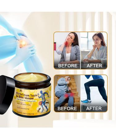 rubeonly 2Pcs Bee Venom Joint Gel Cream Bee Venom Advanced Joint and Bone Cream Advanced Professional New Bee Venom Professional Gel for Back Neck Hands Knee - Buy Online on GoSupps.com