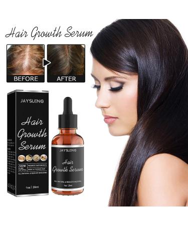 Allurium Hair Growth Serum for Black Women - 2023 New Formula | Anti Hair Loss, Nourishes & Revitalizes Dry Damaged Hair | Fast Natural Growth (3PCS) - Buy Online on GoSupps.com