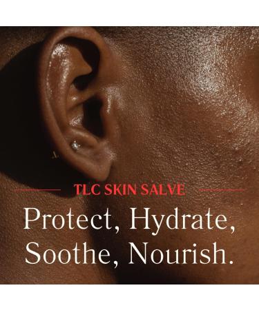 Red Rose Naturals TLC Skin Salve - 100% All Natural Balm for Eczema, Psoriasis, Acne, Dark Spots, Rashes, and Dry Skin - Buy Online on GoSupps.com