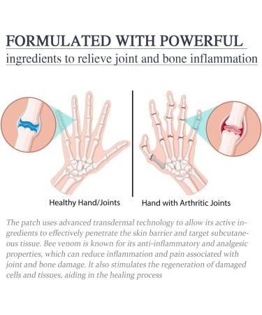 Bee Venom Cream & Beeergift Pain Relief - 60g Advanced New Zealand Gel for Joint Pain (2-Pack) | Fast International Shipping - Buy Online on GoSupps.com