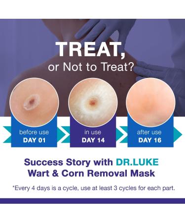 Buy Dr. Luke Corn Removers for Toes - Fast Acting Salicylic Acid Treatment for Corns Calluses & Warts - 0.5 Oz - Effective Deep Corn Removal for Feet & Hands - Buy Online on GoSupps.com