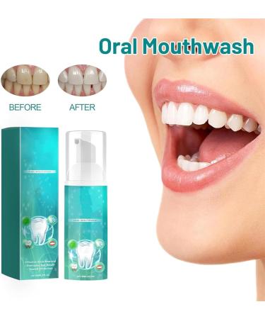 Herbal Mouth Rinsing Foam for Whitening & Gum Health | 2-Piece Set Tartar Removal & Bad Breath Reduction - Buy Online on GoSupps.com