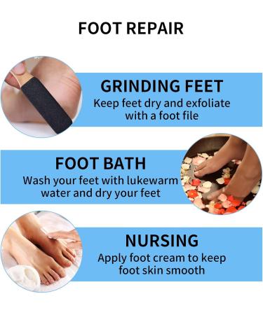 Callus Rasp Callus Callus File Foot File Rasp Files for Foot Care Pedicure Foot Care Device Callus Remover for Soft Smooth Feet - Effective Callus Removal - Buy Online on GoSupps.com