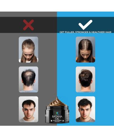 Premium Raw Batana Oil Pure & Unrefined - Advanced Hair Regrowth & Scalp Therapy Device - Supports Fuller Healthier Hair & Skin - For Men & Women 2 OZ - Buy Online on GoSupps.com