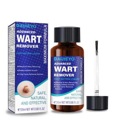 Wart Remover Liquid - Maximum Strength Formula for Rapidly Removing Plantar Warts and Common Warts Safe Natural & Potent Suitable for Most Body Warts