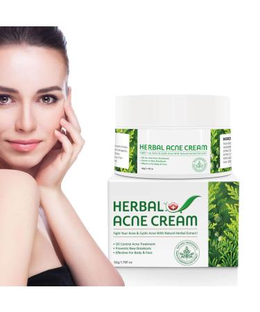Antiacne cream face cream face cream antipimples quickly reduces blemishes targeted solution against pimples