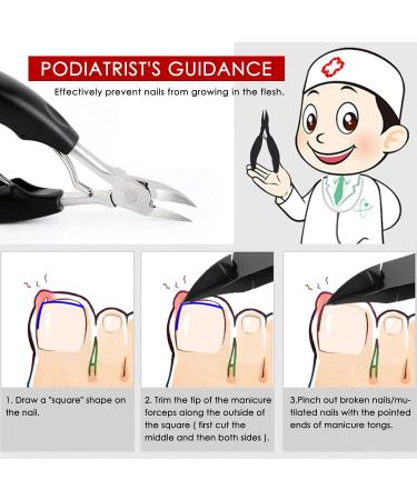 Precision Nail Clippers: Best Tool for Thick or Ingrown Nails, Fungus Nails, Pedicure, and Manicure - Buy Online on GoSupps.com