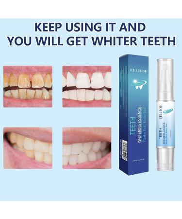 3-Piece Gum Therapy Gel Set | Effective Gum Protection & Tooth Whitening | Stain Removal Solution - Buy Online on GoSupps.com