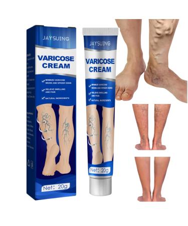 Varicose Veins Treatment for Legs Varicose Veins Cream Spider Vein Treatment for Legs Spider Veins Repair Cream for Varicose Veins Natural Varicose Veins Relief Cream Cream for Varicose Veins in Legs