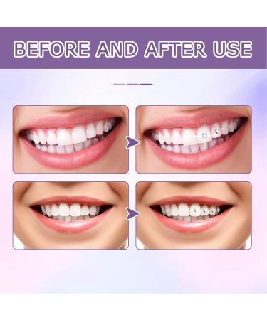 Professional Glue for Tooth Gems - 2pcs 7ML DIY Teeth Decoration & Rhinestone Bonding Resin - Buy Online on GoSupps.com