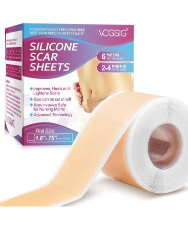Premium Silicone Scar Sheets- Ultra-Thin Flexible and Reusable Medical-Grade Scar Treatment for All Skin Types -Safe and Effective for Scars and Keloids Purple 1.6"x75"