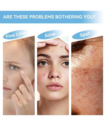 10% Niacinamide Serum + 1% Zinc - For Acne Pore Minimizing & Shine Control - Daily Brightening Facial Serum - Non-Comedogenic For All Skin Types 1 Fl Oz - Buy Online on GoSupps.com